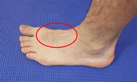 gucci loafers hurt top of foot|Pain on Top of Foot: 5 Causes, Swelling, Treatment .